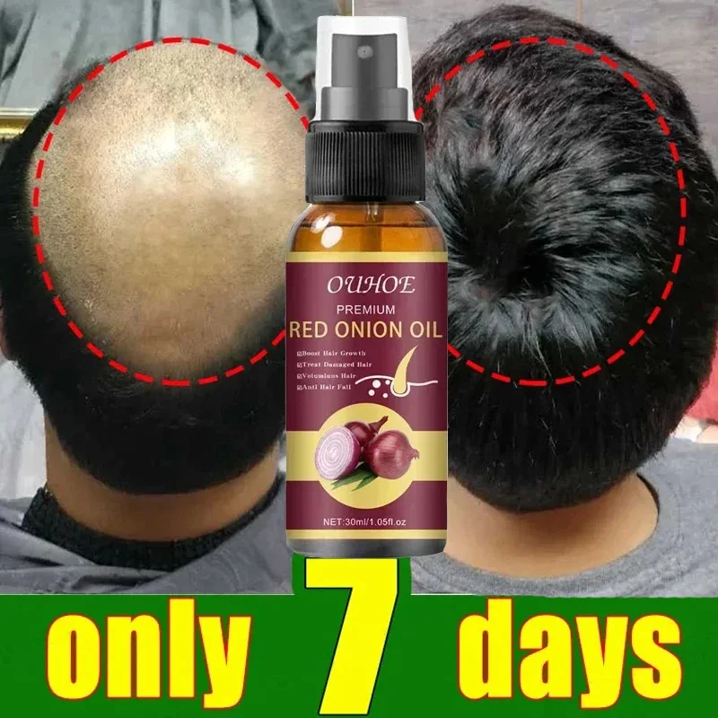 

Powerful Hair Growth Serum Spray Anti Hair Loss Prevent Baldness Essential Oil Scalp Treatment Nourish Hair Care For Men Women