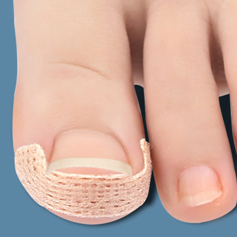 발톱 교정기 스트립 자란 발톱 교정 패치 네일 교정 도구 풋 케어 트리트먼트 패치 경량