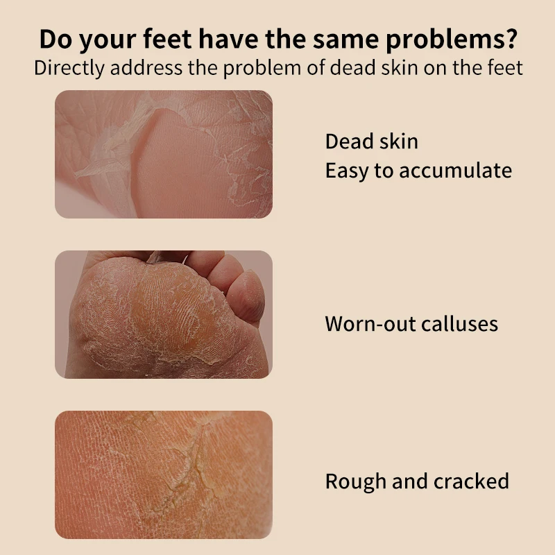 HOMEFISH Dual-Speed Portable Electric Foot File, Household Dead Skin & Callus Remover, Professional Foot Care Tool