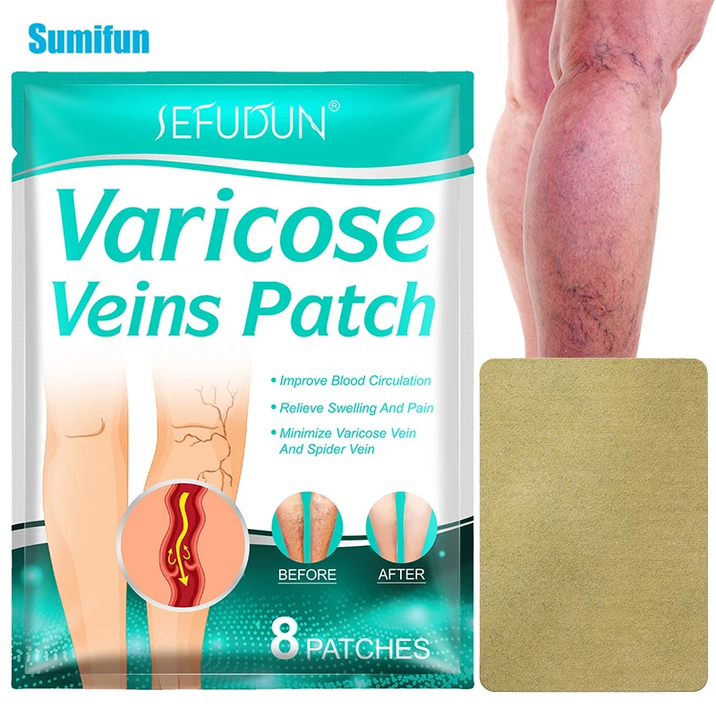 

8pcs Varicose Veins Care Foot Patch Vein Removal Natural Herbal Detox Healing Patch Vasculitis Phlebitis Spider Leg Remover