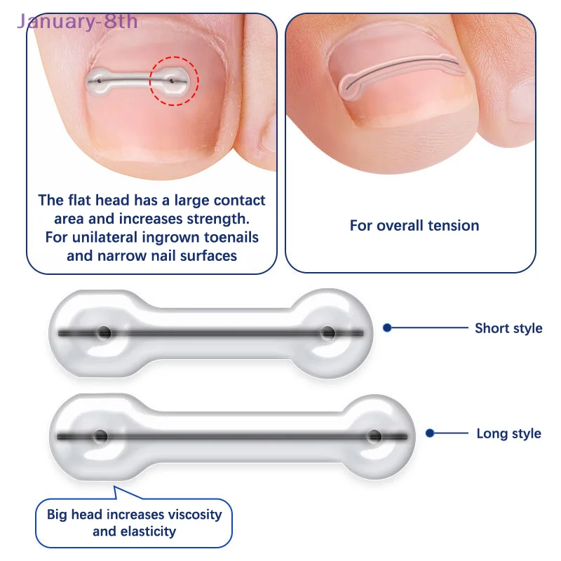 Patch autocollant élastique pour traitement des ongles incarnés, outil de pédicure, pince à redresser, 2 pièces