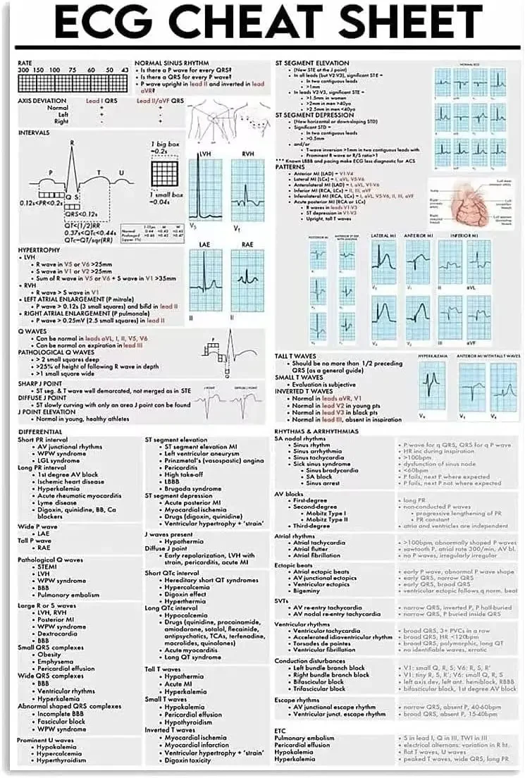 Ecg Cheat Sheet Knowledge Metal Tin Sign Custom Made Vintage Print Poster Wall Art Wallart Decor Craft School Garden