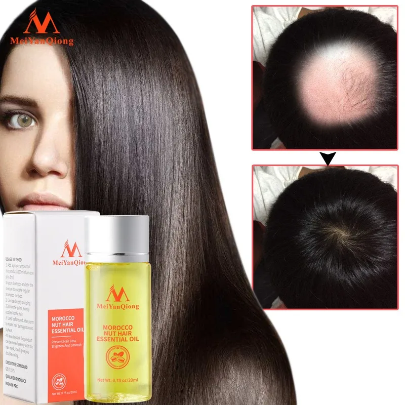 Morocco Nut Oil Promotes Rapid Hair Growth Essential Oils Resist Reduce Prevent Dry Soft Curly Hair Loss Care Damaged Repair