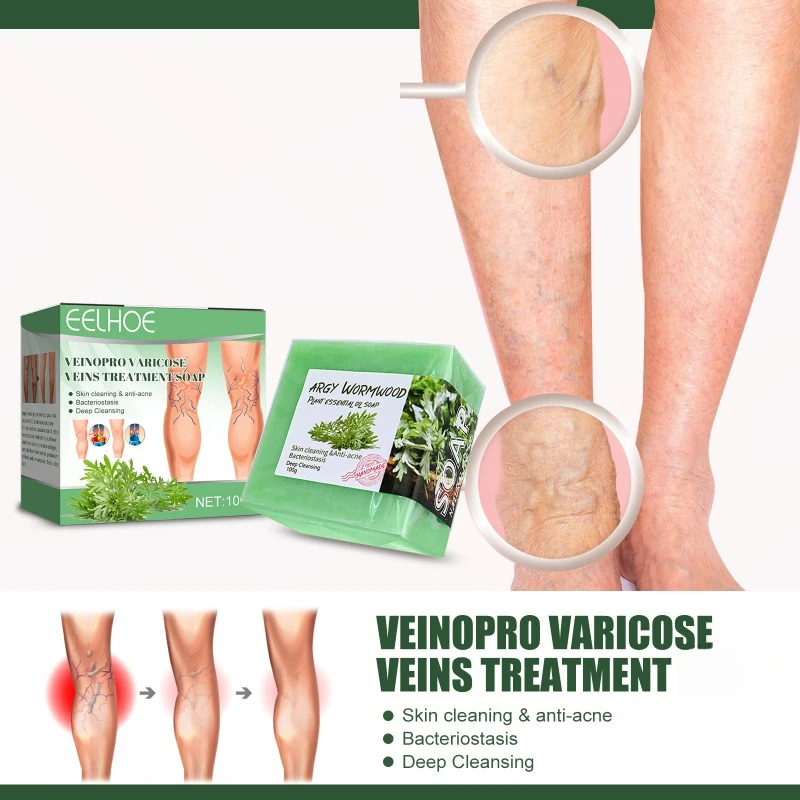 Savon de massage pour les varices Regina Charleroi, soin nettoyant, réparation des jambes, vascularite, phlébite, angiite, douleur des jambes, vers de terre, traitement