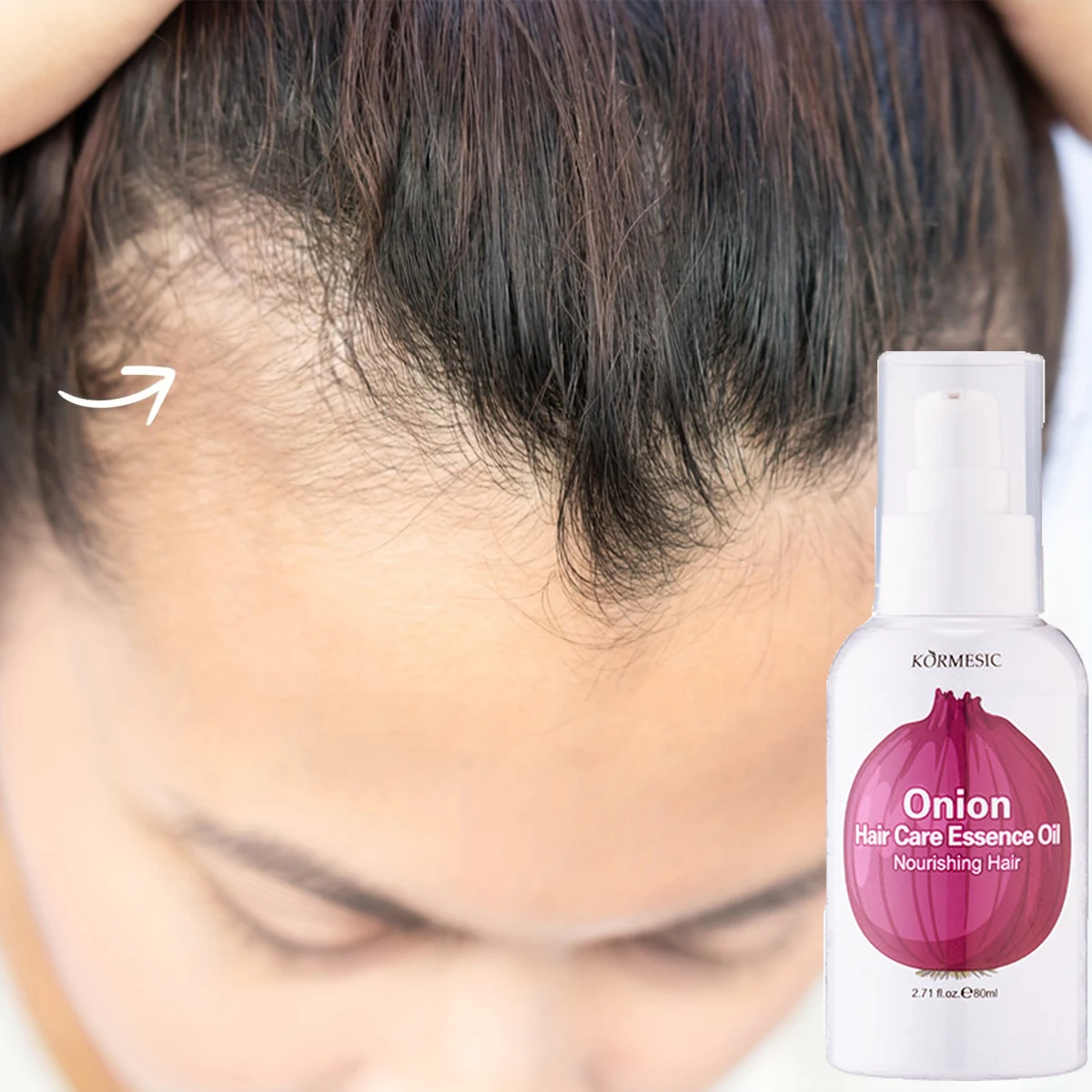 Onion Hair Growth Serum Spray Promotes Hair Growth Oil Repair Hairs Damage Prevent Hair Loss Nourish Scalp Hair Health Care 80ml - Image 6