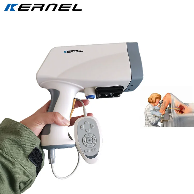 Gynecological examination equipment digital video colposcope