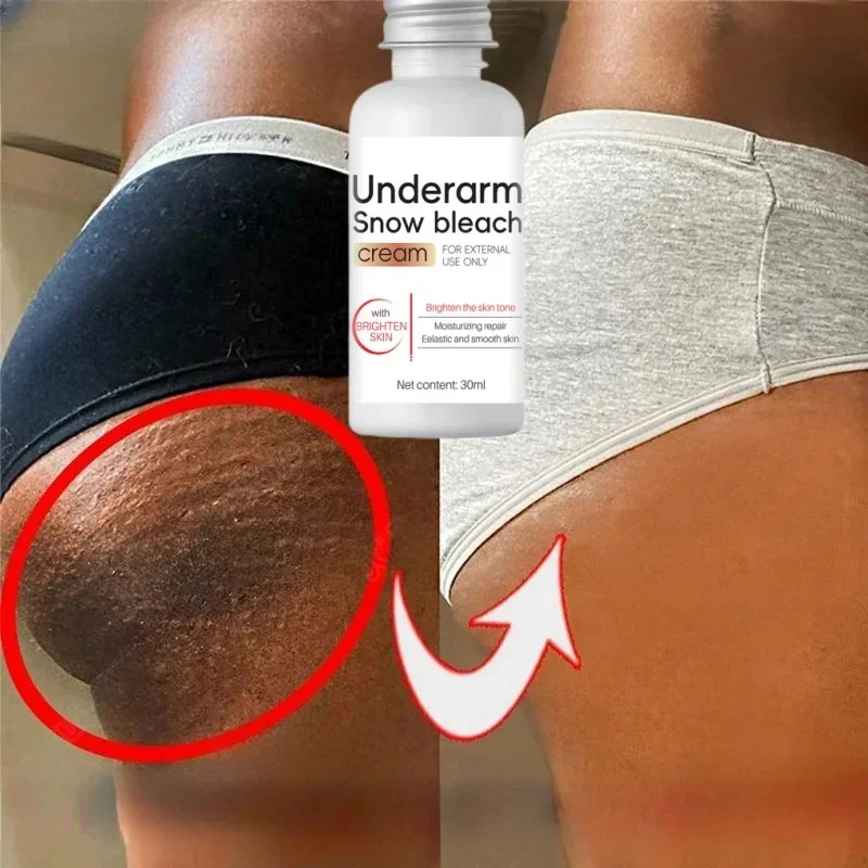 Creme de clareamento partes íntimas axilas soro de branqueamento clarear bunda joelho iluminar parte interna da coxa peças íntimas escuro remover melanina