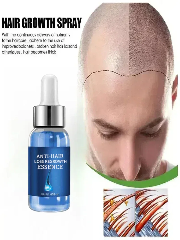 You need a hairstyle!! Hair is getting more and more, say goodbye to baldness, hair becomes thicker, hot selling products.