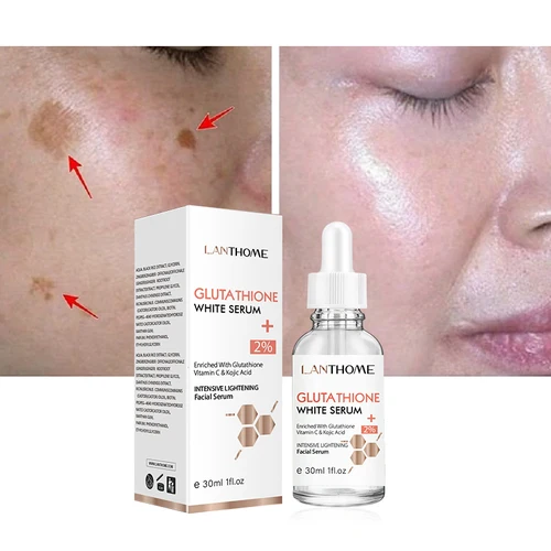 Imagen 2 del producto Lanthome-suero blanqueador de glutatión para mujer, decoloración de manchas oscuras negras, defectos de vitamina C, Reduce el aceite Facial, iluminador y reafirmante