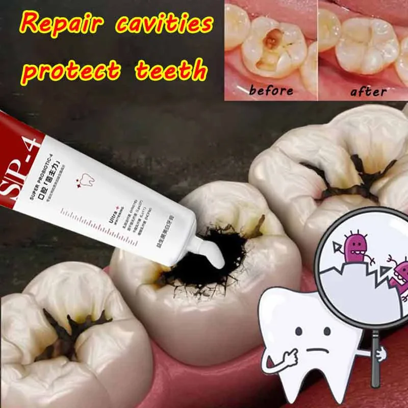 Probiotic Caries Toothpaste SP4 Whitening Repair Tooth Decay Paste Cleaner Teeth Remover Plaque Fresh Breath Oral Care