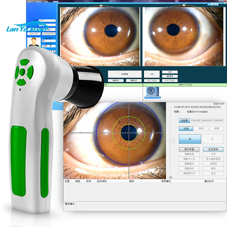 Portable Iriscope Iris Analyzer Auto Iridology Camera Eye Iriscope Analyzer Software