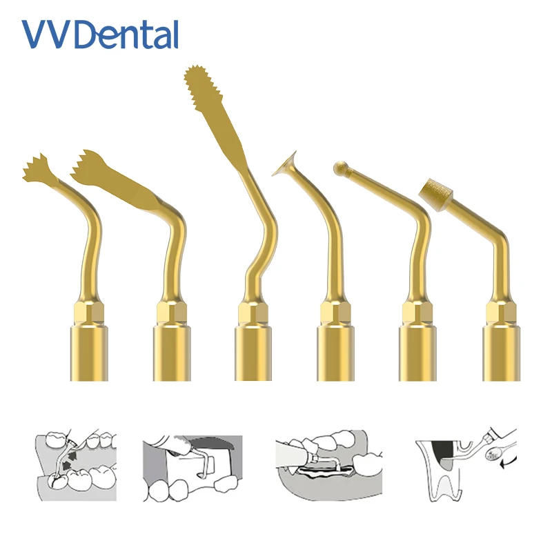 Dentale Piezochirurgie-Spitze für Mectron Woodpecker Sinus-Lifting, Scaling, Implantat, Exelcymosis, Dentalmaschine, Mikrosäge, Knochenschneiden – Detail 2