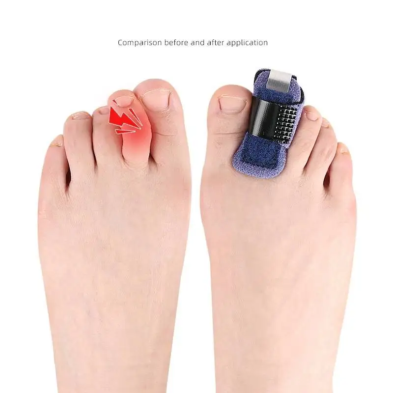 1/2/10Pcs Splint Toe Straightener Hammer Corrector Toe Brace Hammertoe Splint Toe Wrap Covers Broken bunion corrector Foot Care