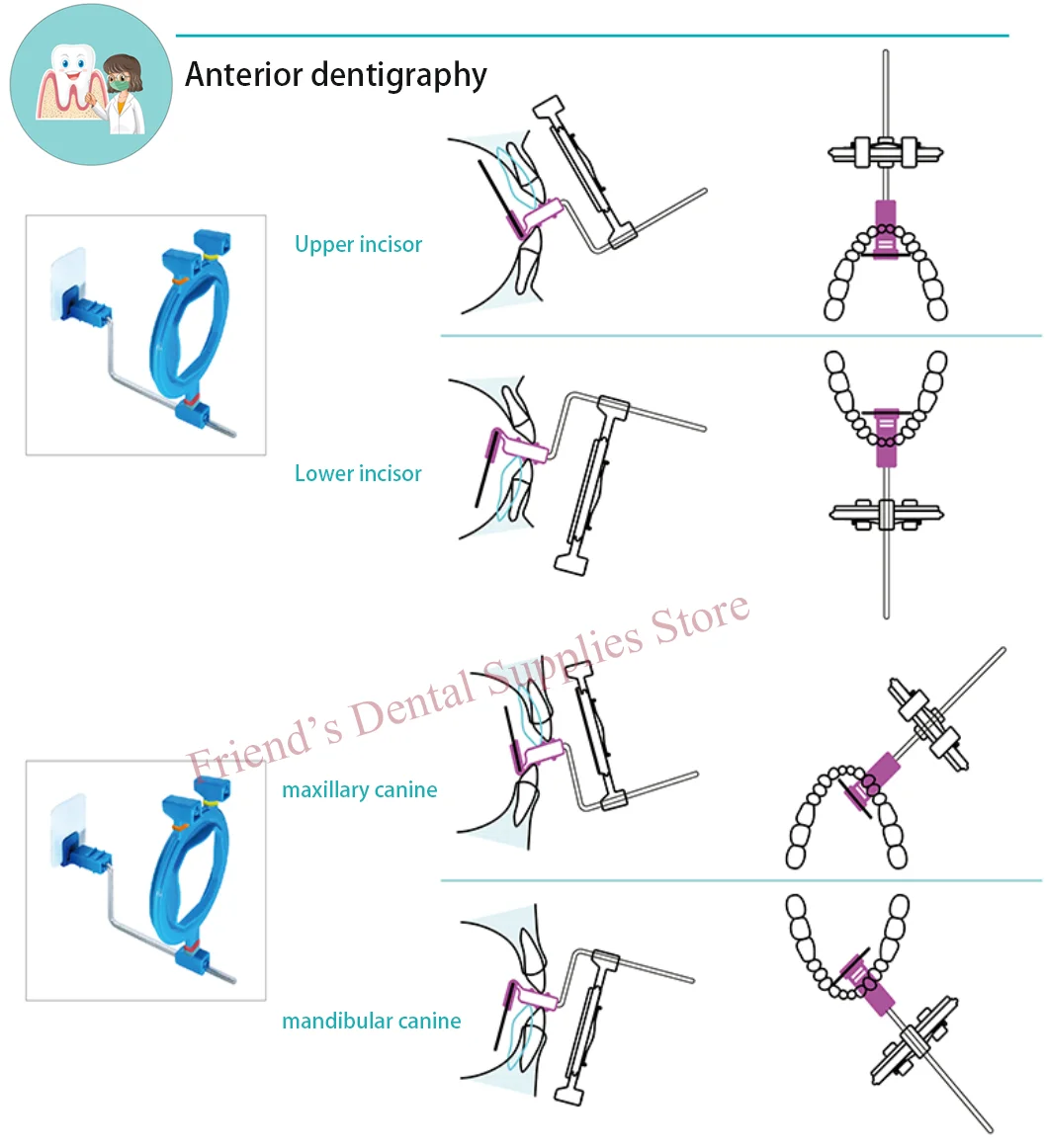 12 uds/Kit sistema de posicionamiento de rayos X Dental para película + películas de placa de fósforo posicionador de soporte de posicionamiento de placa de fósforo