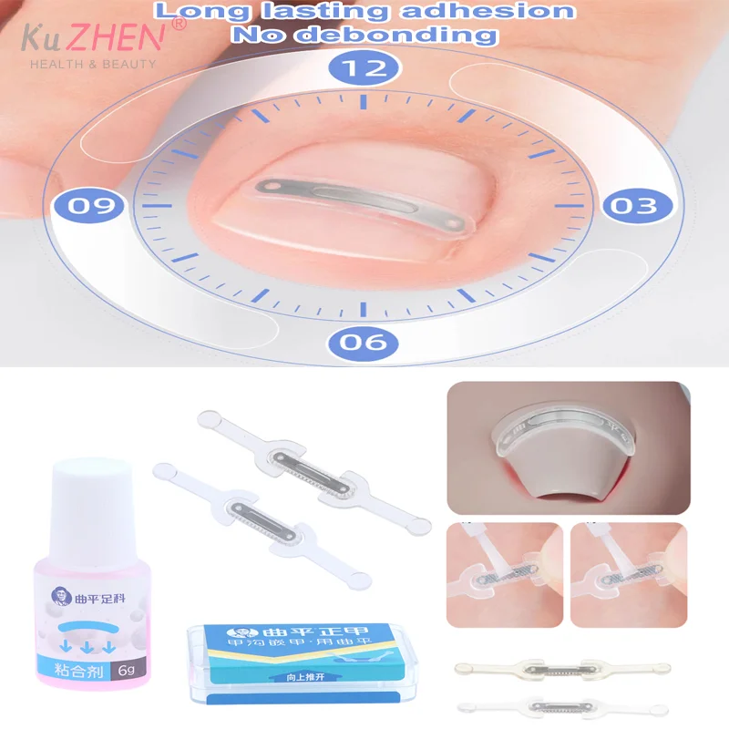 Ingrown Toenail Correction Ingrown Toe Nail Treatment Elastic Patch Sticker Straightening Clip Brace Nail Care Pedicure Tool