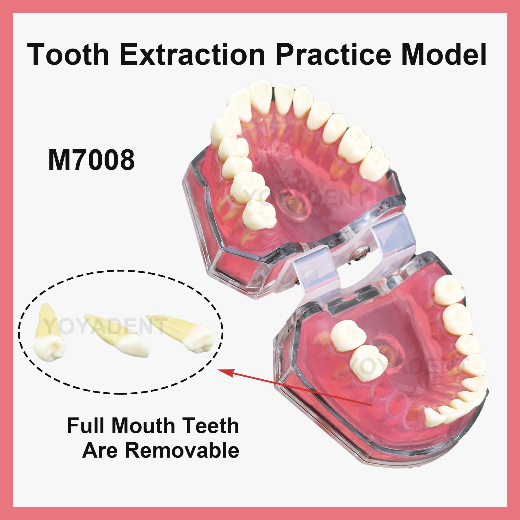 

Dental Teaching Model Removable Tooth Model Simulated Cheek Doctor-Patient Communication Model Soft Gums Are Removable