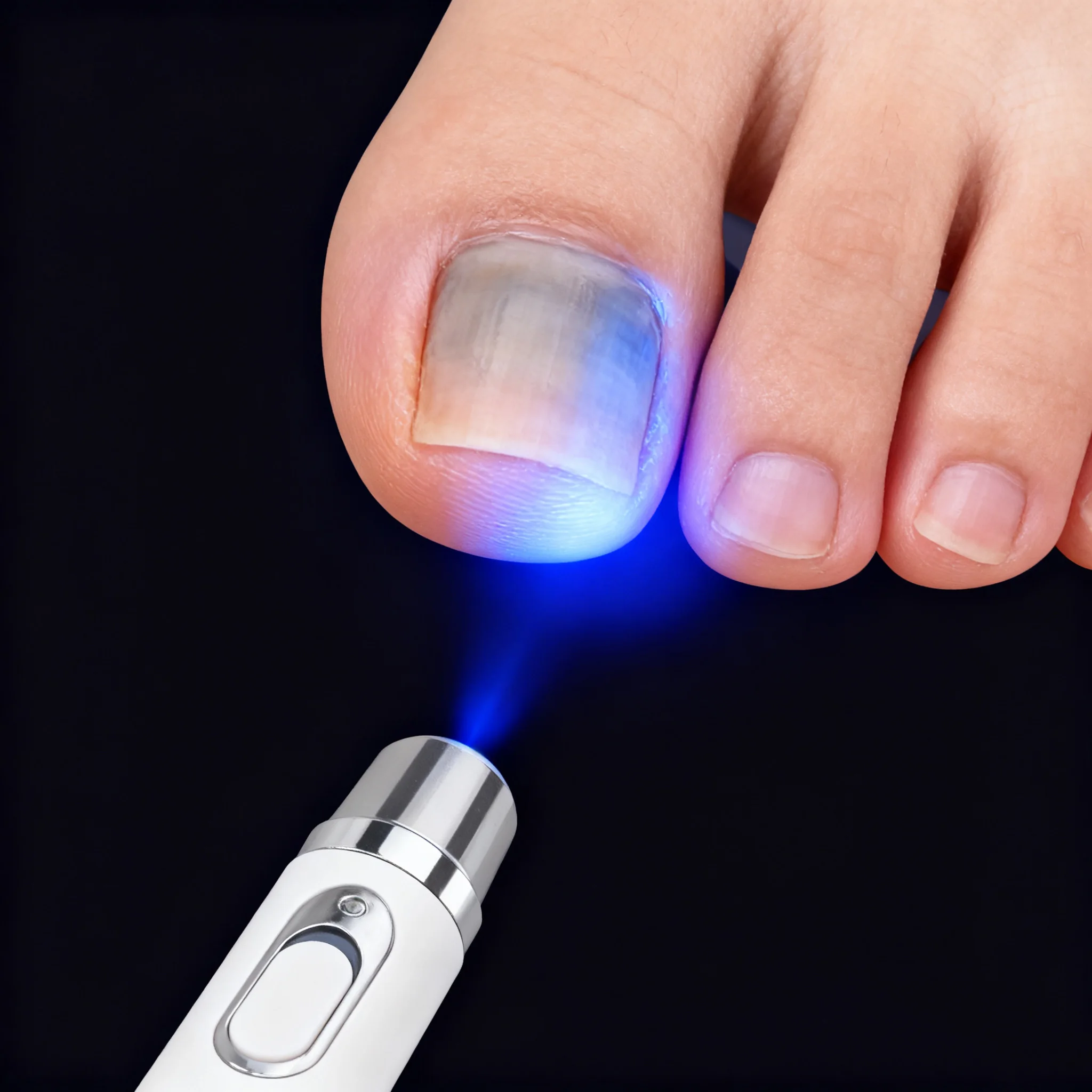 18 Quickly Eliminate Fungus and Restore Healthy Nails