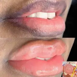 Lips Pink Fresh Fast Lightening Bleaching Cream Balm Treatment Remove Dark Lips Smoke Lip Gloss Tubes Beauty Lipgloss Men Women