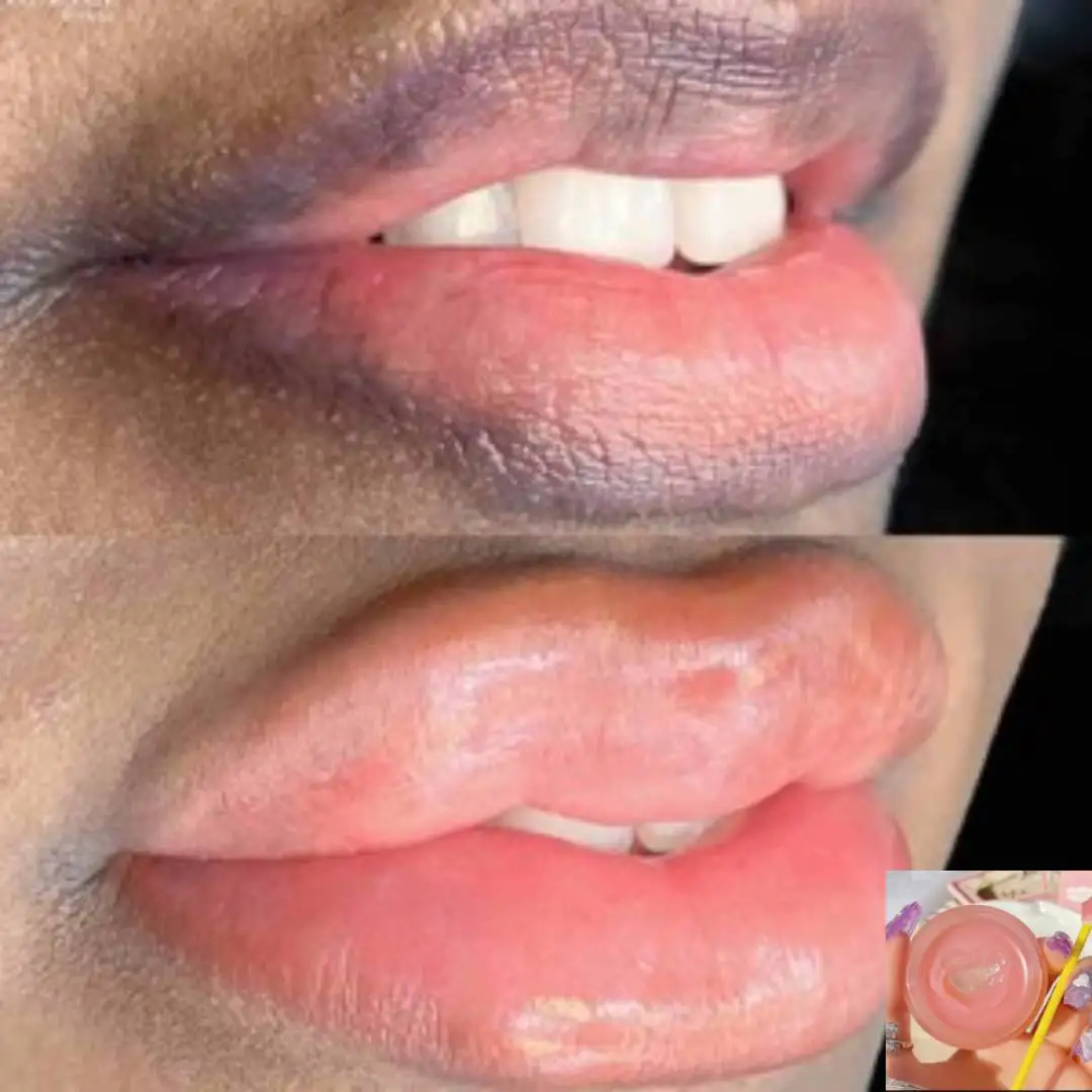 Lips Pink Fresh Fast Lightening Bleaching Cream Balm Treatment Remove Dark Lips Smoke Lip Gloss Tubes Beauty Lipgloss Men Women