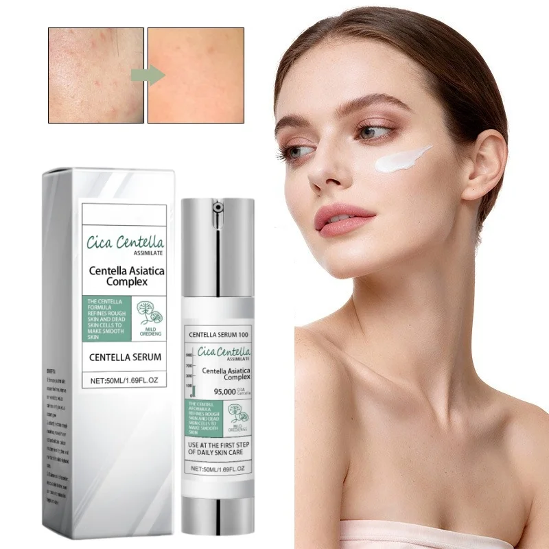 100/300/700 Centella Asiatica Serum, High-efficiency Moisturizing Lotion Correcting Glow Serum, Centella Asiatica Plumpness Skin