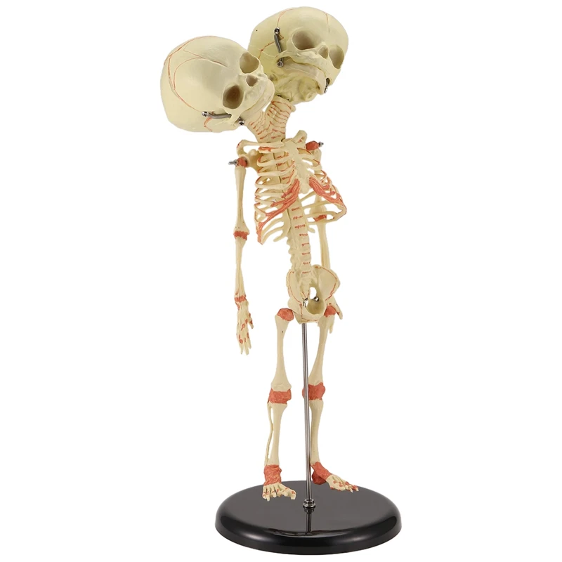 A35Q-Human Body Double Heads Baby Skull Bone Anatomy Brain For Display Research Teaching