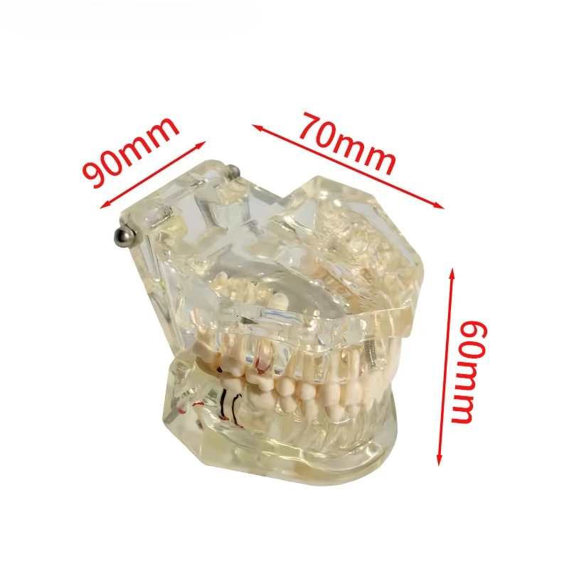 Dental Teeth Model Standard Implant Disease Dentist Studying Demo Dental Typodont Model With Removable Teeth Restoration Bridge