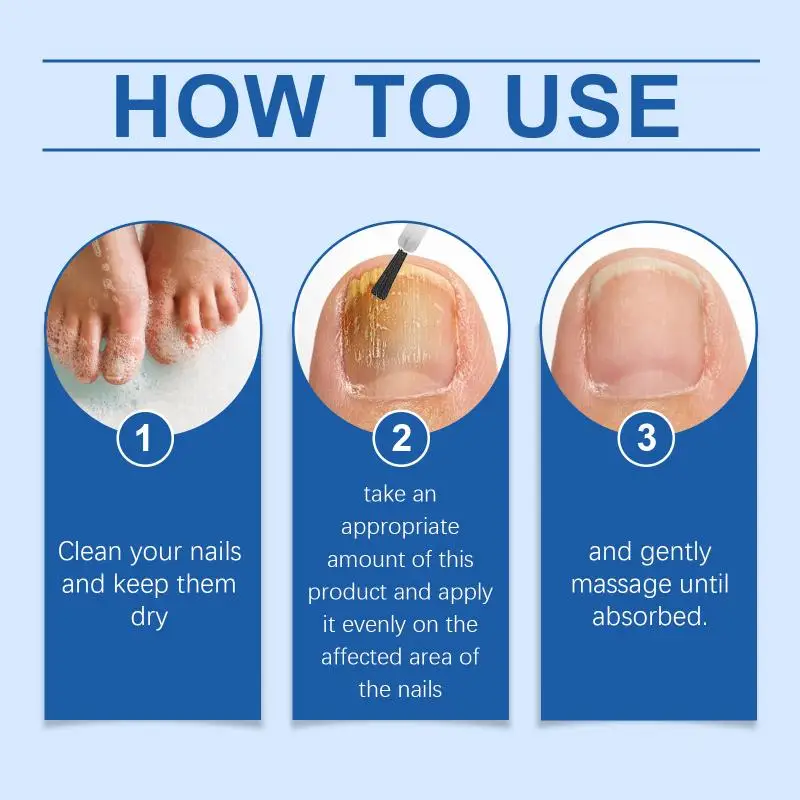Bee Venom Nail Oil with Salicylic Acid for Nail Hardening Visible Strengthening Home Care for Fragile Nails Solution