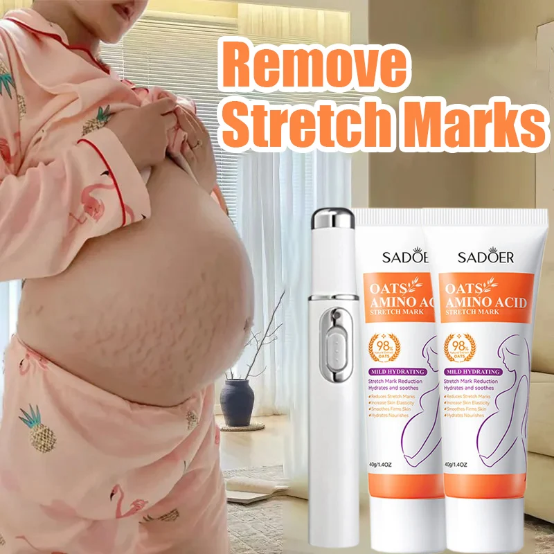 

Remove Stretch Marks Laser Pen Treatment For Abdomen Stretch Marks Moisturize Hydrating Anti Wrinkle For Abdominal In Pregnancy