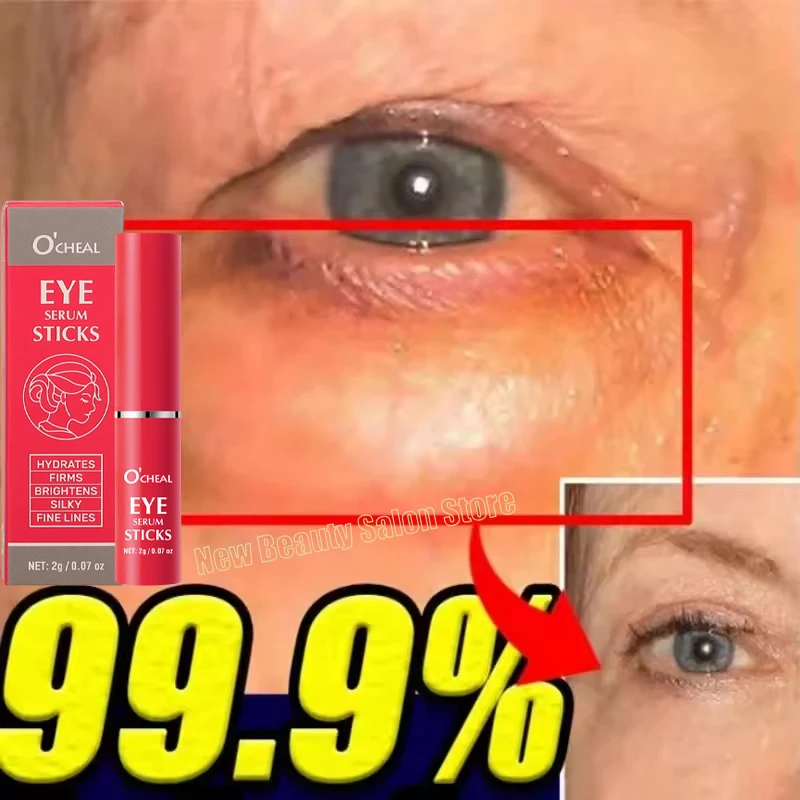 

Instant Eyes Bag Remove Collagen Eye Cream Fade Dark Circle Fine Line Fat Particles Anti-Puffiness Moisturizing Firming Eye Care