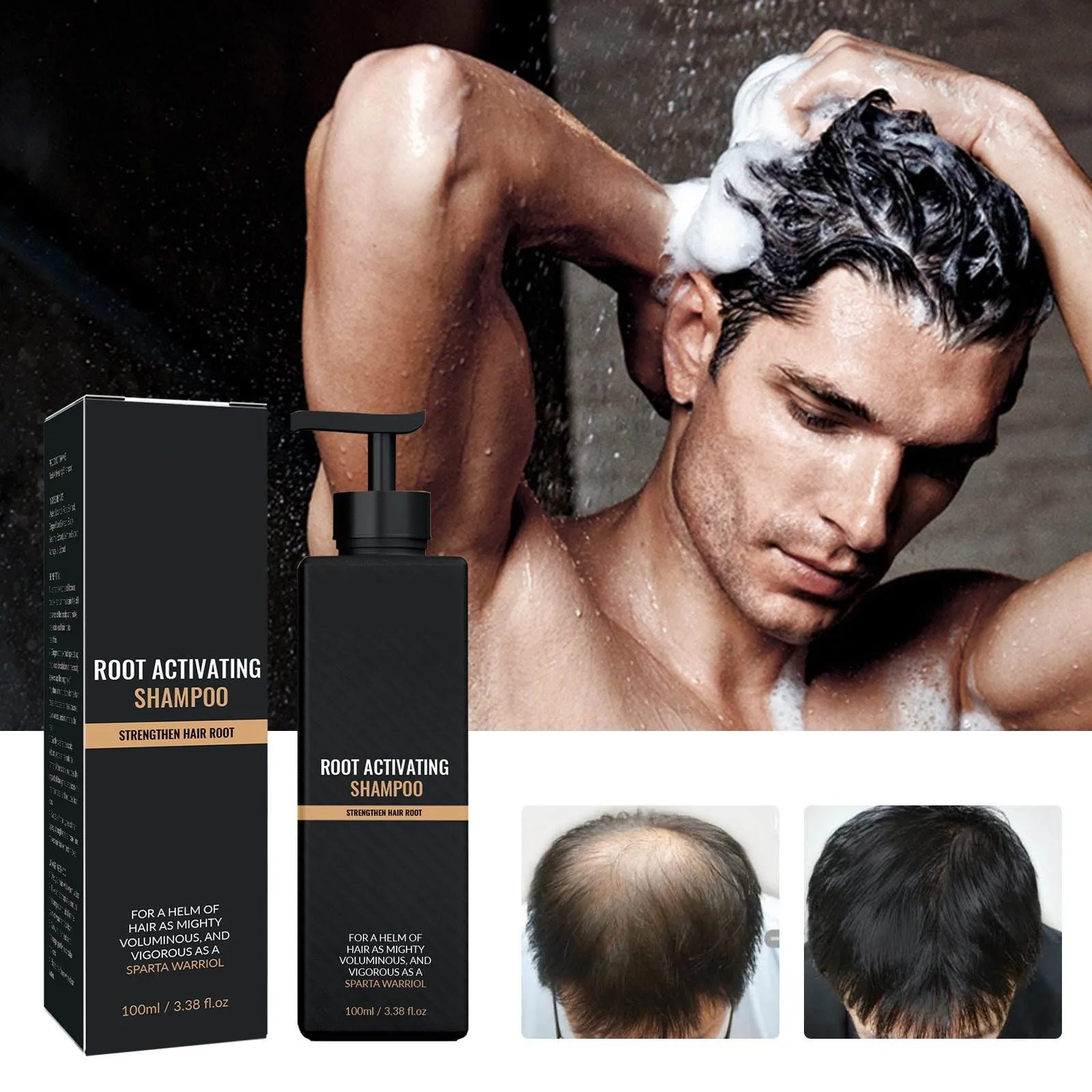 Hair Regeneration And Hair Loss Shampoo,Fast Thickening,Deep Cleansing Of Hair Follicles,Strengthening Of Hair Nutrition,100ML