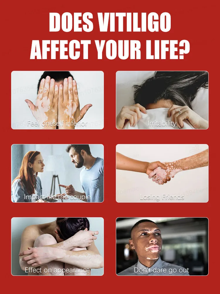 The laser pen is gentle and only acts on the ʷʰⁱᵗᵉ ˢᵖᵒᵗˢ ʷⁱᵗʰᵒᵘᵗ ᵈᵃᵐᵃᵍⁱⁿᵍ ʰᵉᵃˡᵗʰʸ ˢᵏⁱⁿ‧