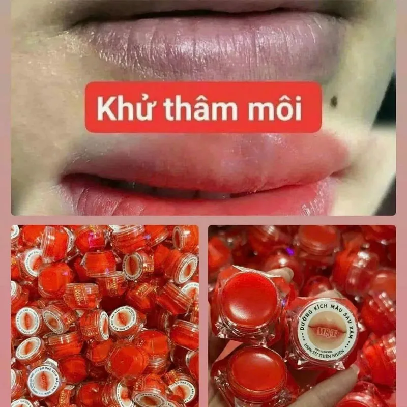 Duong Moi MT Tri Tham Moi Duong Mau Moi Vietnam Lip mud Moisturizing Soft pink Remove Dark Lips Dry Crack 5g Men Women