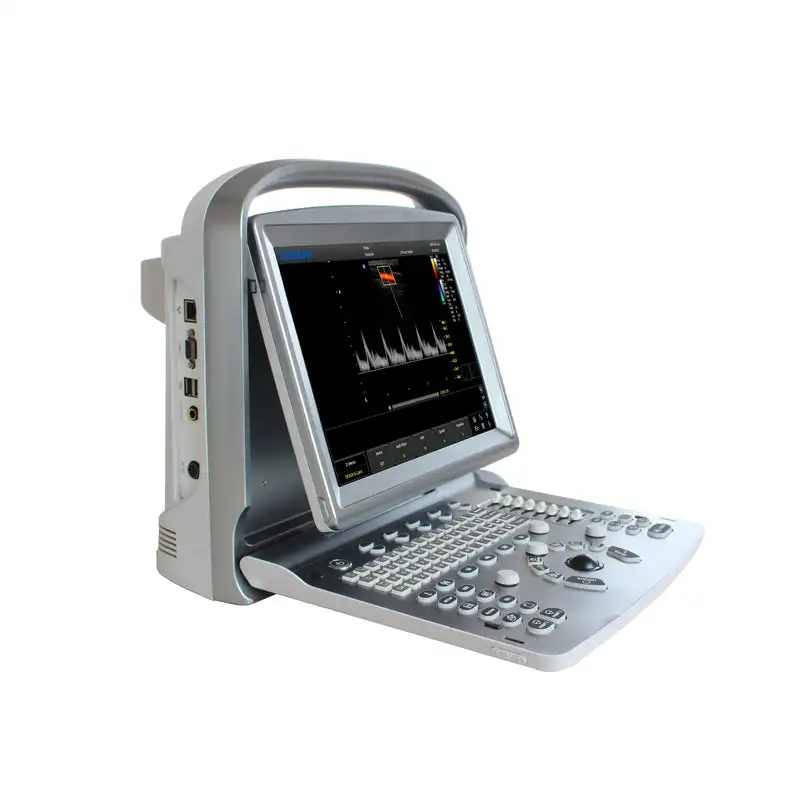 الموجات فوق الصوتية الممتازة Chison Eco5 البيطري الماشية البيطرية الخيل البقري #4