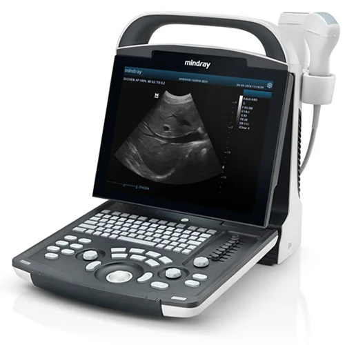 Mindray DP-10 Ultrasound Full Digital Ultrasonic Diagnostic Imaging System B/W Portable Ultrasound Machine