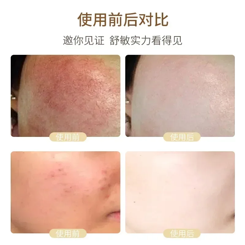Liquorice Face Serum Stock Solution Repairing The Barrier Reduces Facial Redness Essence Original Skin Care Brightening Moisturi