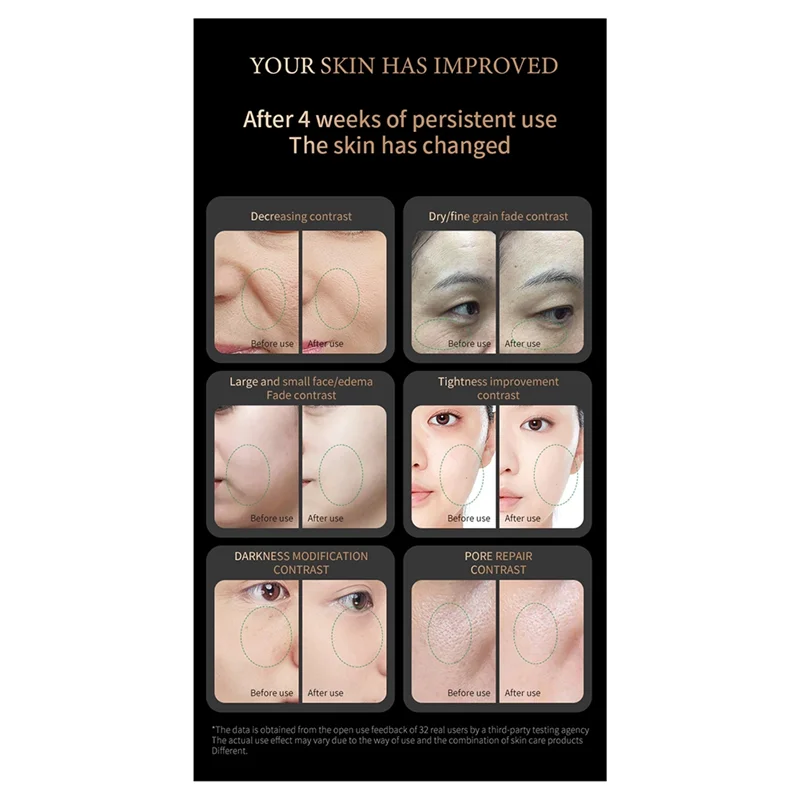 

RF Radio Frequency Facial Spa Machine Wrinkle Removal Skin Face Tightening Beauty Care Device Collagen Gold