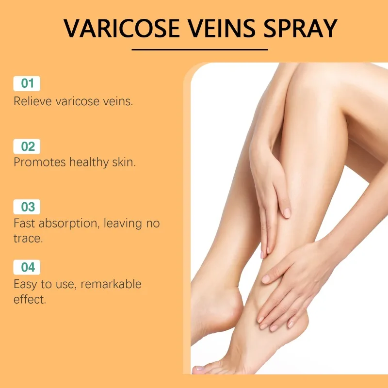 Équation Venom Leg Care Spray, Charleroi Eve Phlebitis, SAP oto, Atténue l'engourdissement, 03/instituts de Leg Varicose Disconfort Leg Care Spray