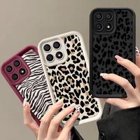 Retro Black Leopard Zebra Print Phone Case for Xiaomi MI 14T Pro 5G 14 12T 11 Lite 5G NE POCO X6 X5 X3 M6 Pro Trendy Cover Soft