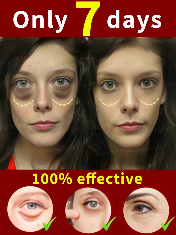 

over 90% buyer says the eyes bag could never be an issue