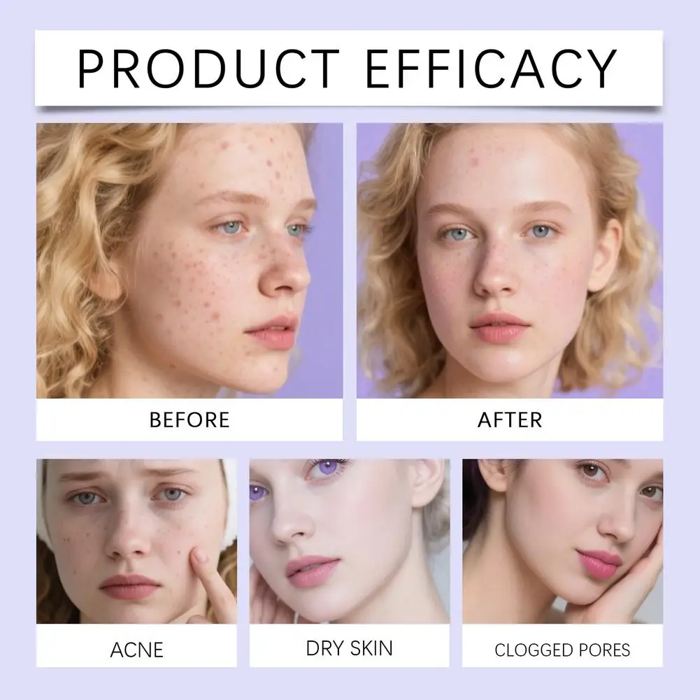 Уход за кожей лица, акне, прыщи, пластырь, невидимый профессиональный исцеляющий впитывающий пятно, наклейка, покрытие для мужчин и женщин