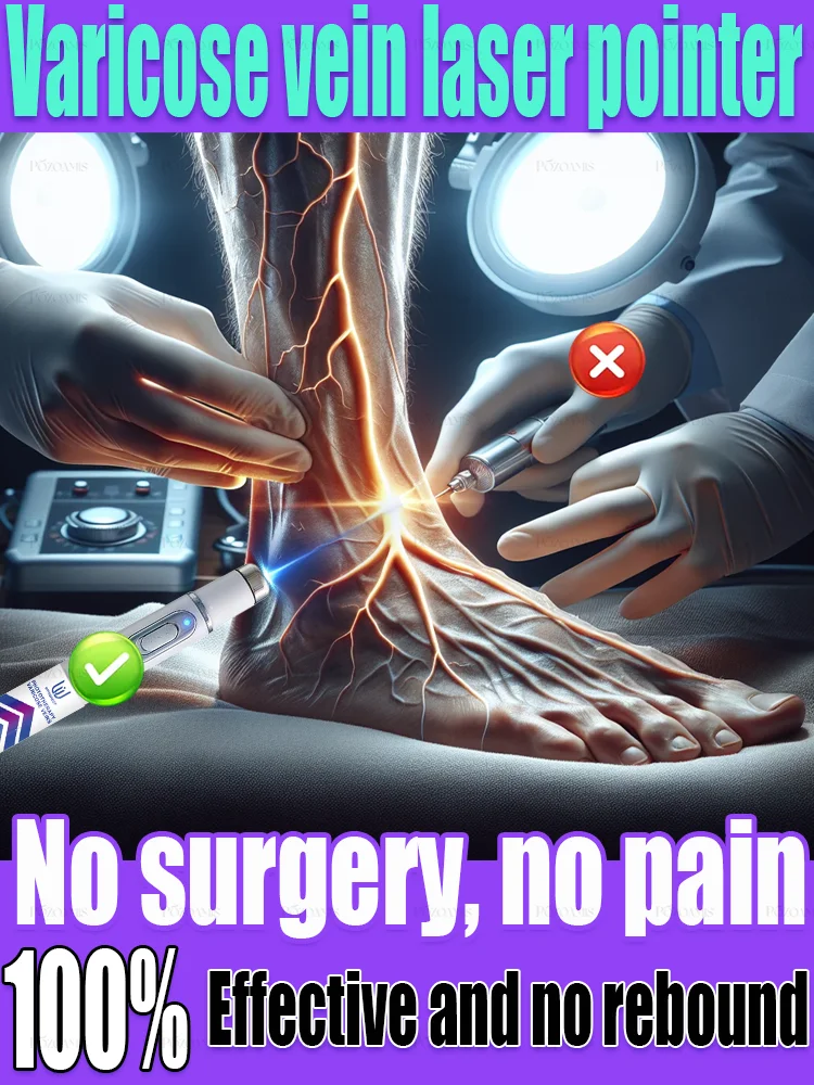 

Tʜɪʀᴅ ɢᴇɴᴇʀᴀᴛɪᴏɴ ᴠᴀʀɪᴄᴏsᴇ ᴠᴇɪɴ ʟᴀsᴇʀ ᴇʟɪᴍɪɴᴀᴛᴇs ᴠᴀsᴄᴜʟɪᴛɪs ᴀɴᴅ ᴘʜʟᴇʙɪᴛɪs, ʀᴇʟɪᴇᴠᴇs sᴘɪᴅᴇʀ ʟᴇɢ ᴘᴀɪɴ, ʟᴀsᴇʀ ᴘᴏɪɴᴛᴇʀ ᴛʜᴇʀᴀᴘʏ