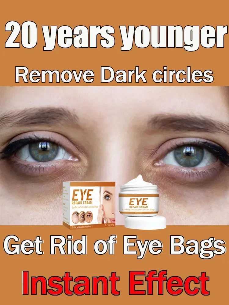 Dark Circles Eye cream Remove eye bags Puffiness Anti-Wrinkle way work under eyes Lightening Moisturizing Whitening Skin Care