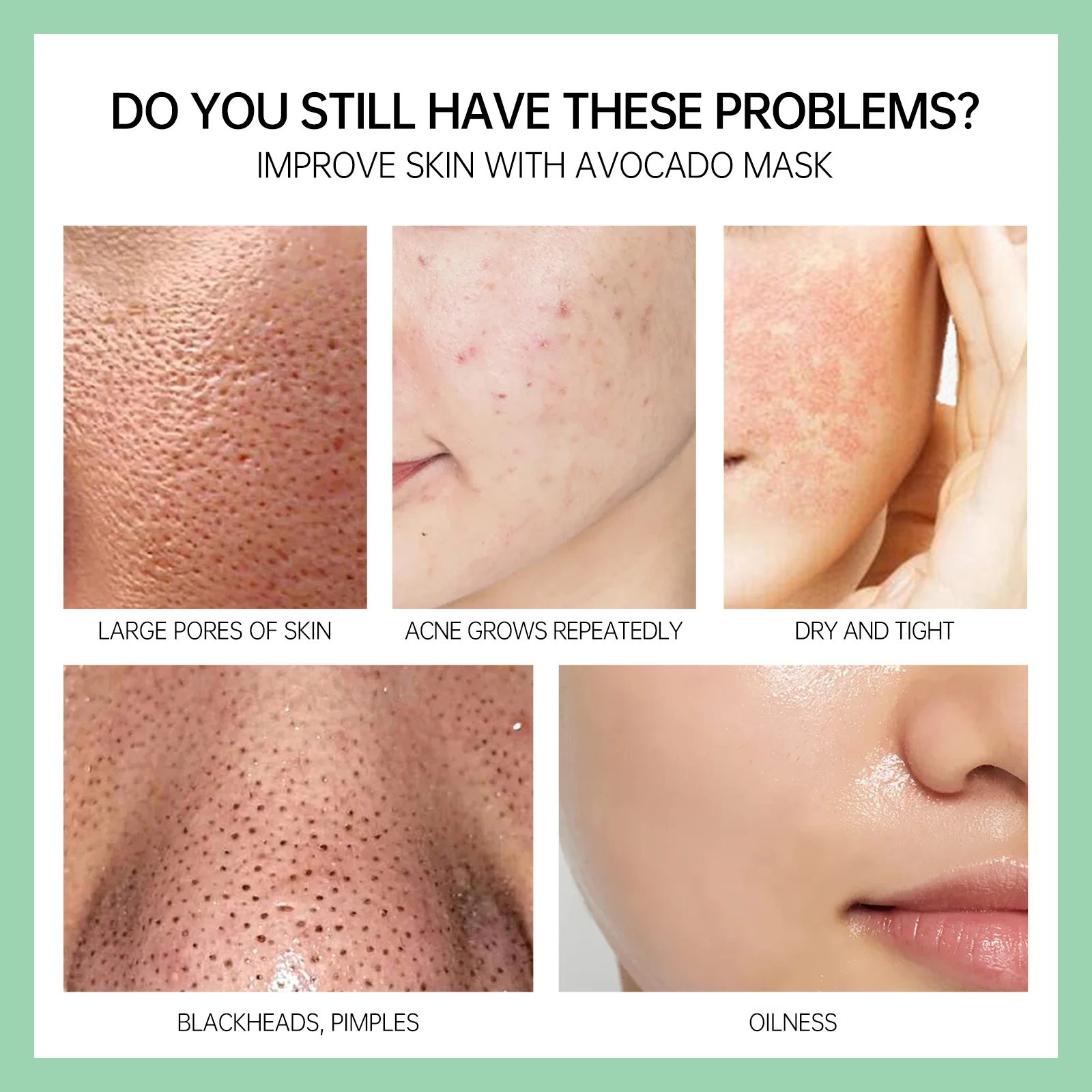 Mascarilla de arcilla de árbol de té, eliminador de espinillas, limpieza profunda, Control de aceite, mascarilla Facial hidratante anti puntos negros, mascarilla Facial de barro, cuidado de la piel