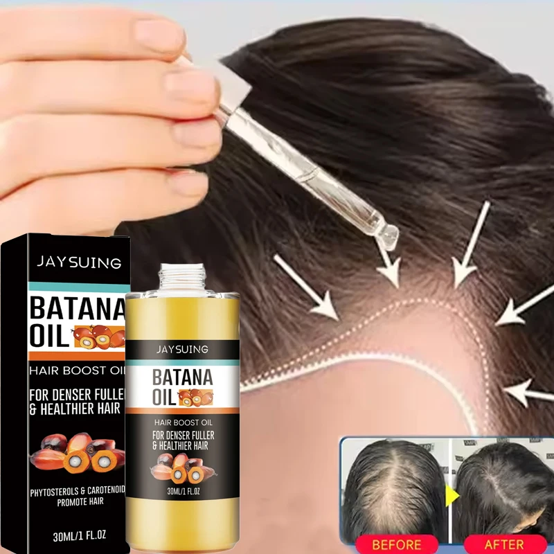 

Fast Hair Growth Set Batana Oil Traction Alopecia Hair Mask Anti Break Loss Hair Growth Oil Baldness Treatment Hair Health Care