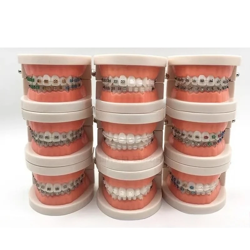 Adult Dental Model for Standard Teaching Orthodontic Metal Wire And Bracket Educational Demonstration Dental Model