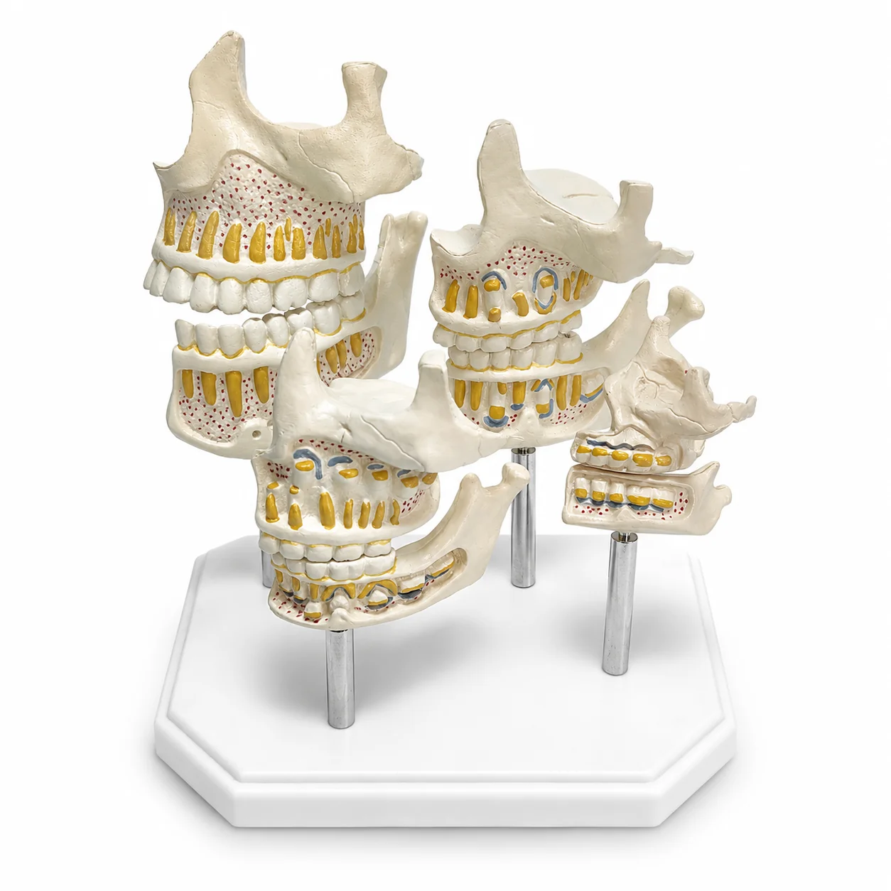 modello-anatomico-del-sviluppo-dentale-umano-a-4-fasi-espositore-didattico-per-l'eruzione-dei-denti-della-superiore-e-inferiore-in-8-pezzi-con-base