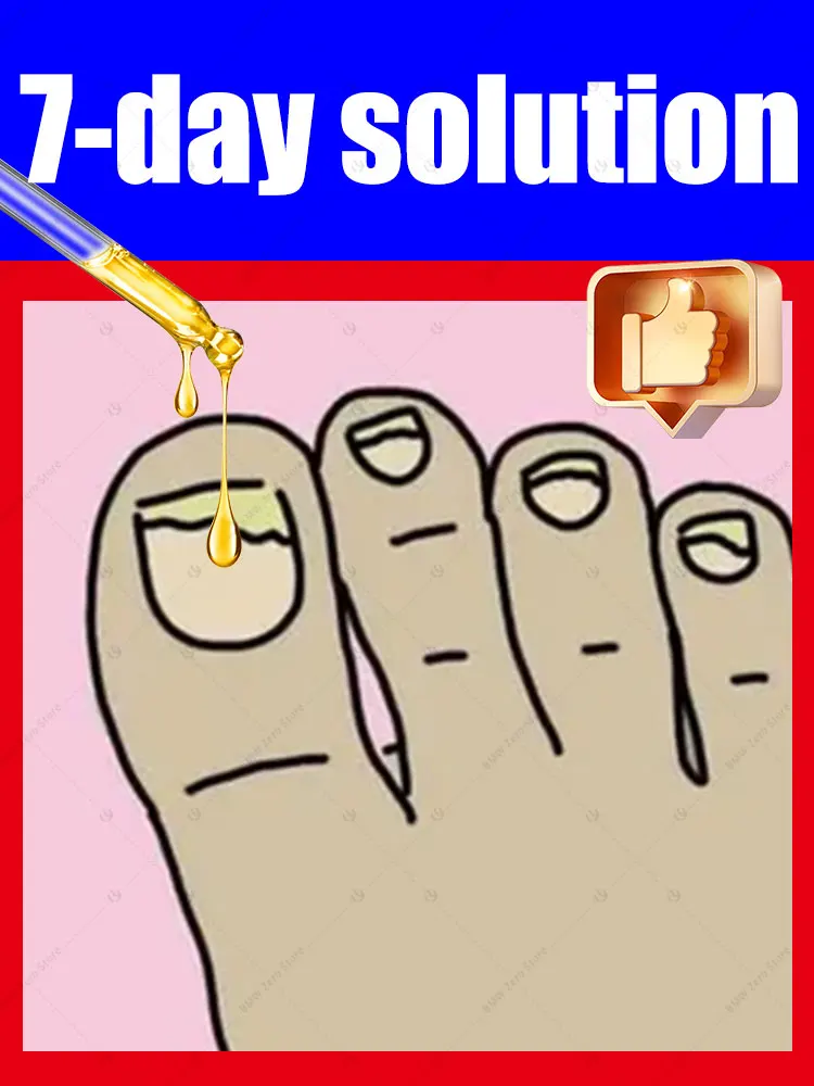 

Painless replacement of nails