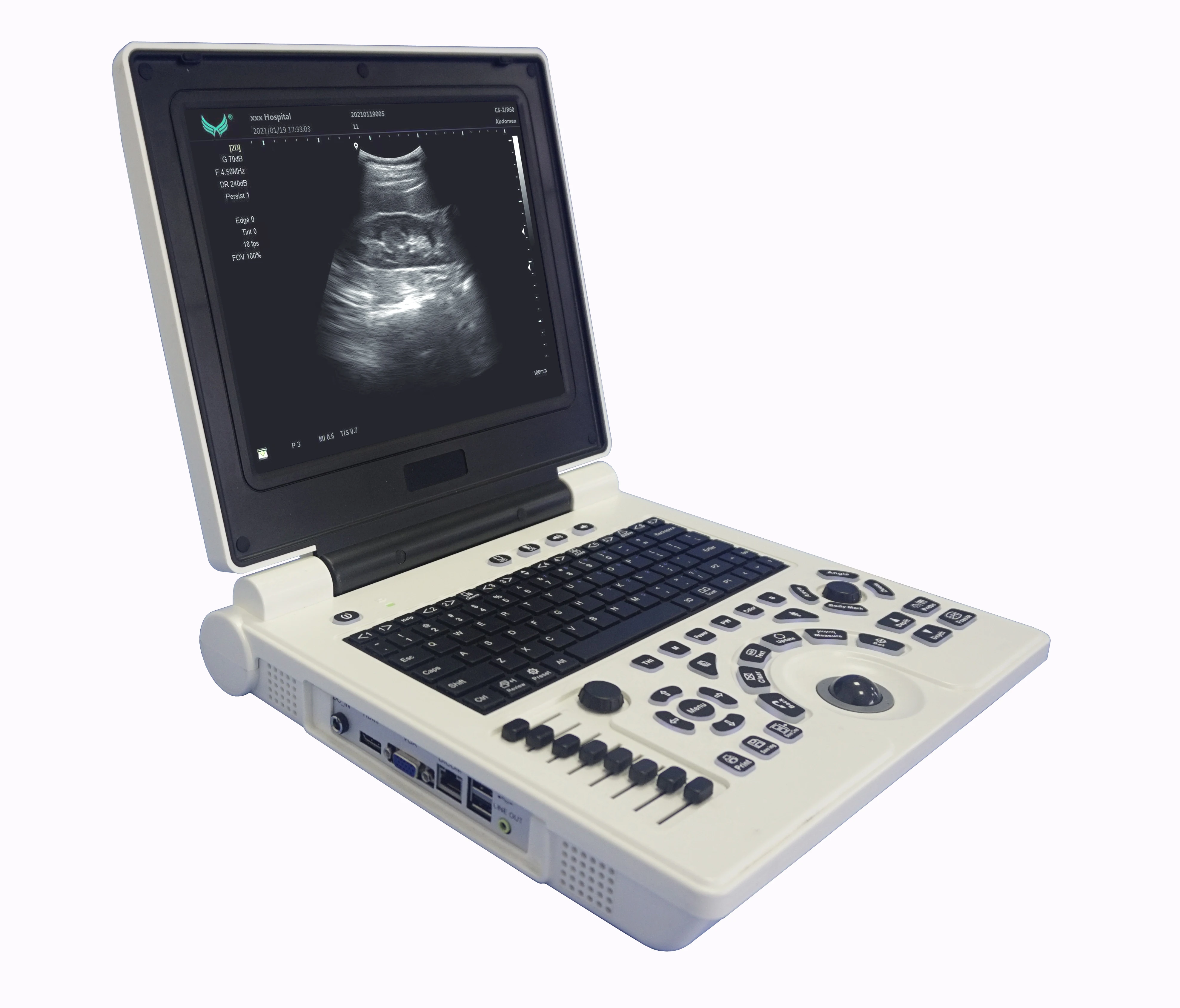 2021 Latest Wholesale Sonoscape E20 3D 4D Color Doppler Ultrasound Portable