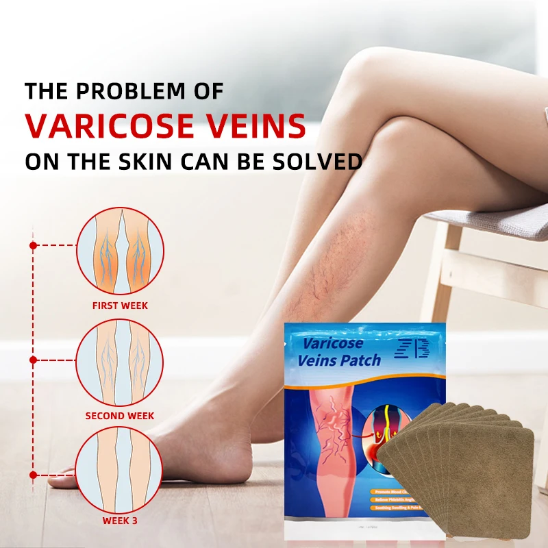 6pcs Varicose Veins Patch Vasculitis Phlebitis Spider Cream Varicosity Angiitis Ointmnet Removal Herbal Medical Plaster