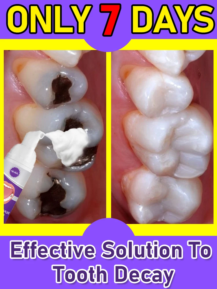 

tooth repair